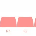 black-pink-rabbit-candy-moa-keycapset-size