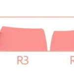 fault-clearing-mda-keycap-set-size