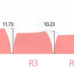 rome-asa-keycap-set-size