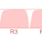 chiikawa-characters-moa-keycap-set-size
