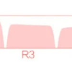 chiikawa-usagi-soa-keycap-set-size