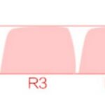 party-pig-moa-keycap-set-size