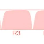 luo-xiaohei-moa-keycap-set-size