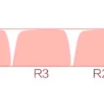 meow-kitchen-xoa-keycap-set-size